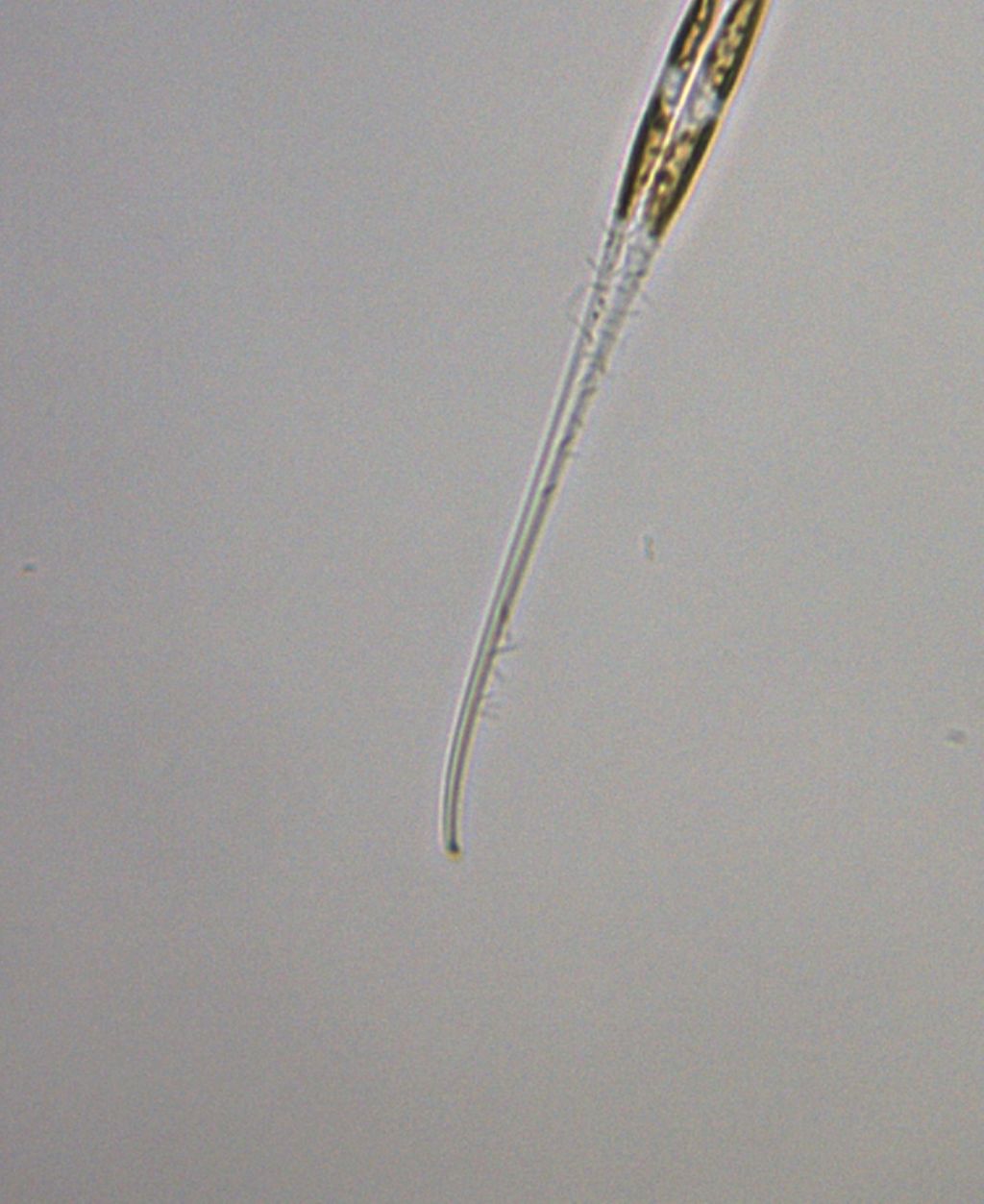 La mia Fata ha una coscia sola e pure pelosa